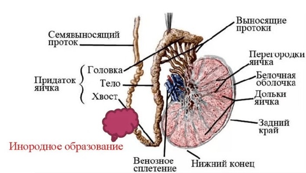 Фото: Причины секреторной формы бесплодия у мужчин